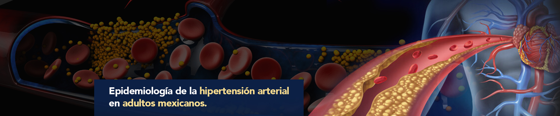 “Epidemiología de la hipertensión arterial en adultos mexicanos: diagnóstico, control y tendencias. ENSANUT 2020